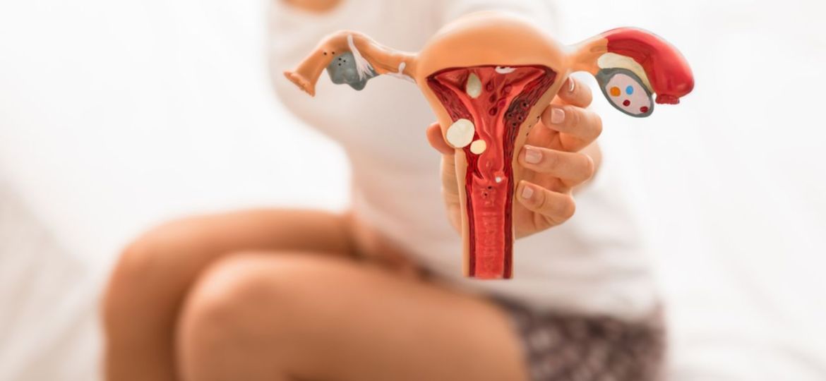 Quais são os primeiros sintomas da endometriose